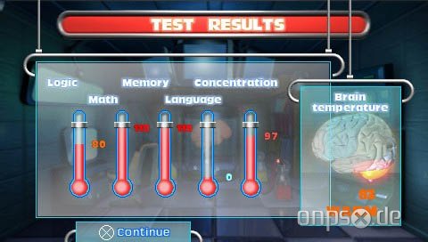Hot Brain
