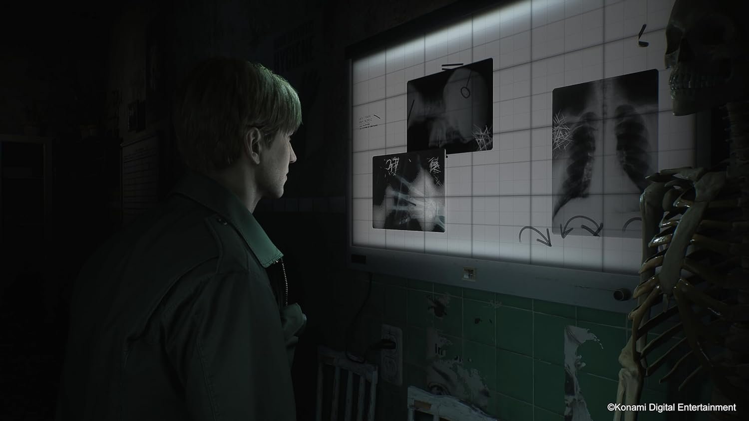 Silent Hill 2 Remake knackt 2,5 Millionen Marke